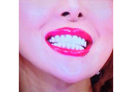 女優などの不気味に白すぎる人工歯は危険！1本17万円、深刻な体調不良を招くおそれの画像1
