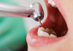 歯科治療で死亡事故発生…意外に恐ろしい麻酔とデンタルショックの話