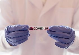 新型コロナ「イベント等の自粛」はどのような効果があると言えるか　過去のパンデミックデータから考える