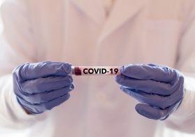 新型コロナ、上昌広医師の「PCR検査拡大」はデマ？「医療崩壊を招く恐れ」と物議