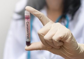 新型コロナ、PCR検査抑制は日本政府の英断か…徹底的な検査で医療崩壊したイタリアと韓国