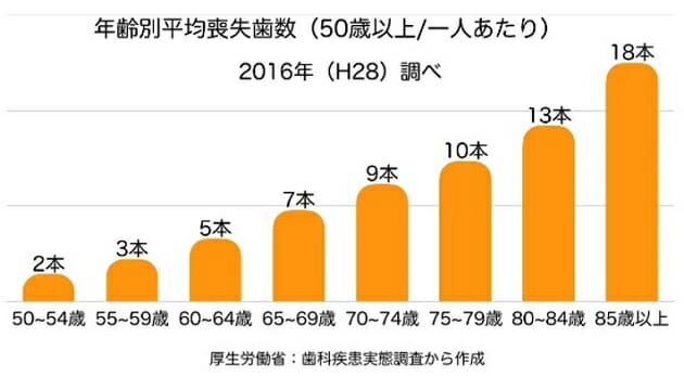 平均的日本人、70歳超で10本の歯を失っている！健康寿命を延ばすカギは入れ歯？の画像1
