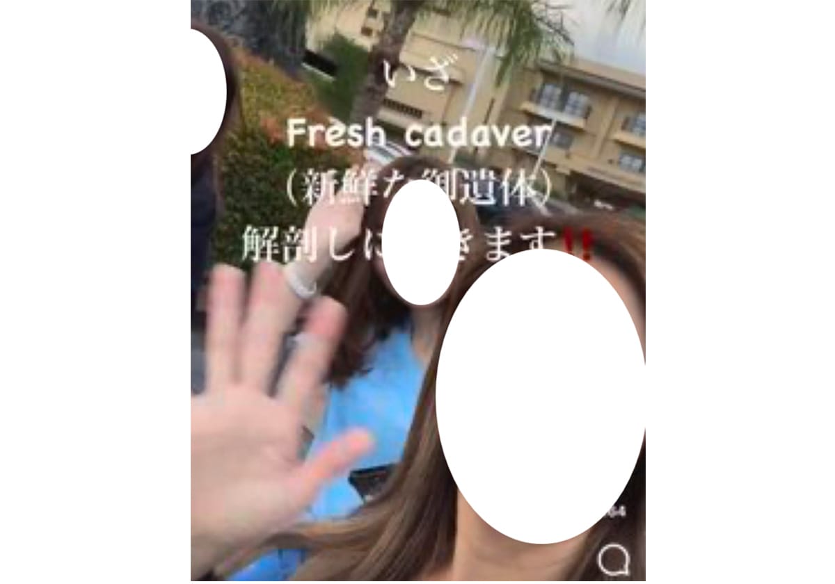 解剖でピース写真の東京美容外科の医師、年収3千万円超か…免許返納に値かの画像1