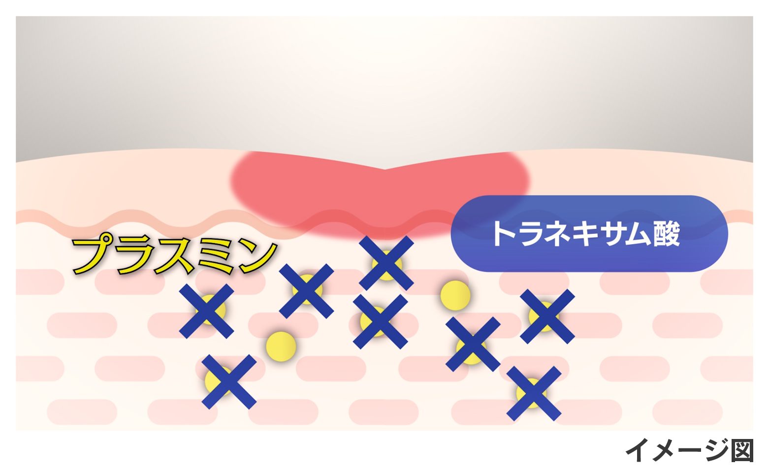 生活者と共創し革新を続ける…第一三共ヘルスケア、トラネキサム酸研究開発の最前線の画像2