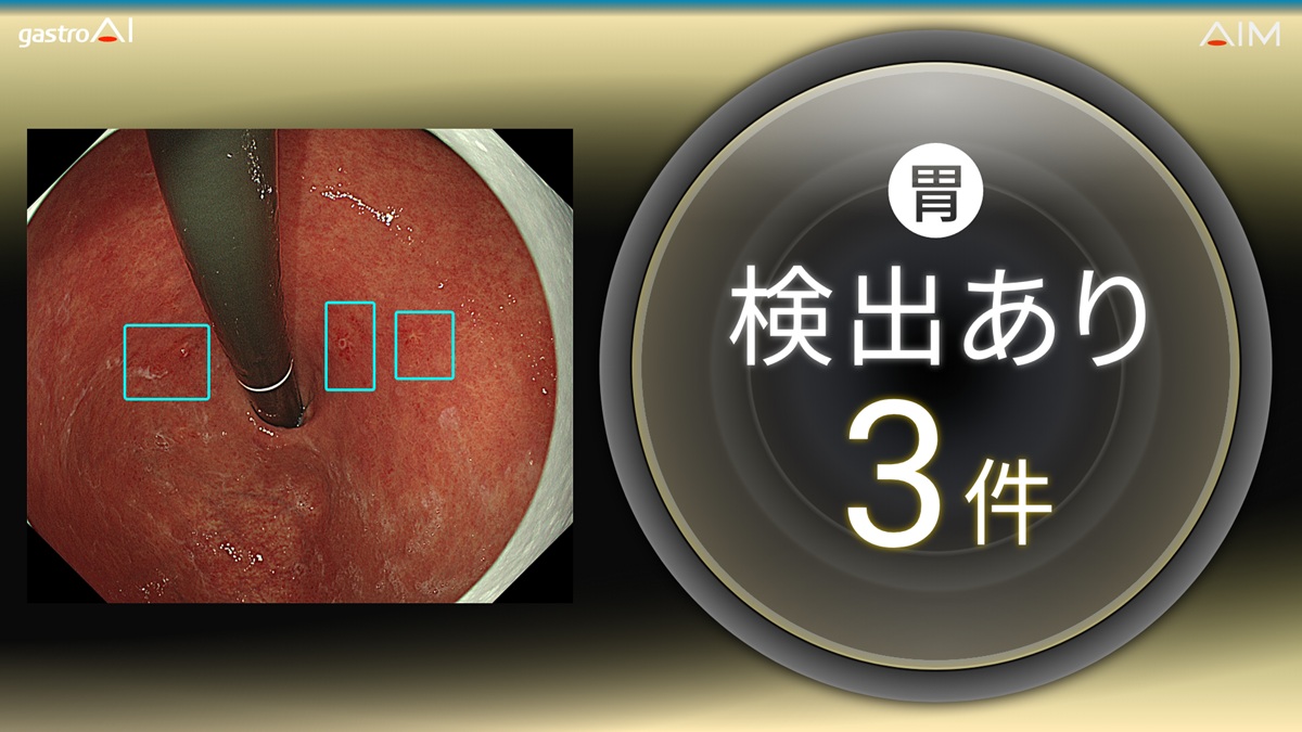 1200件の検査を一人で…AI医療機器×地方医療の最前線の画像2