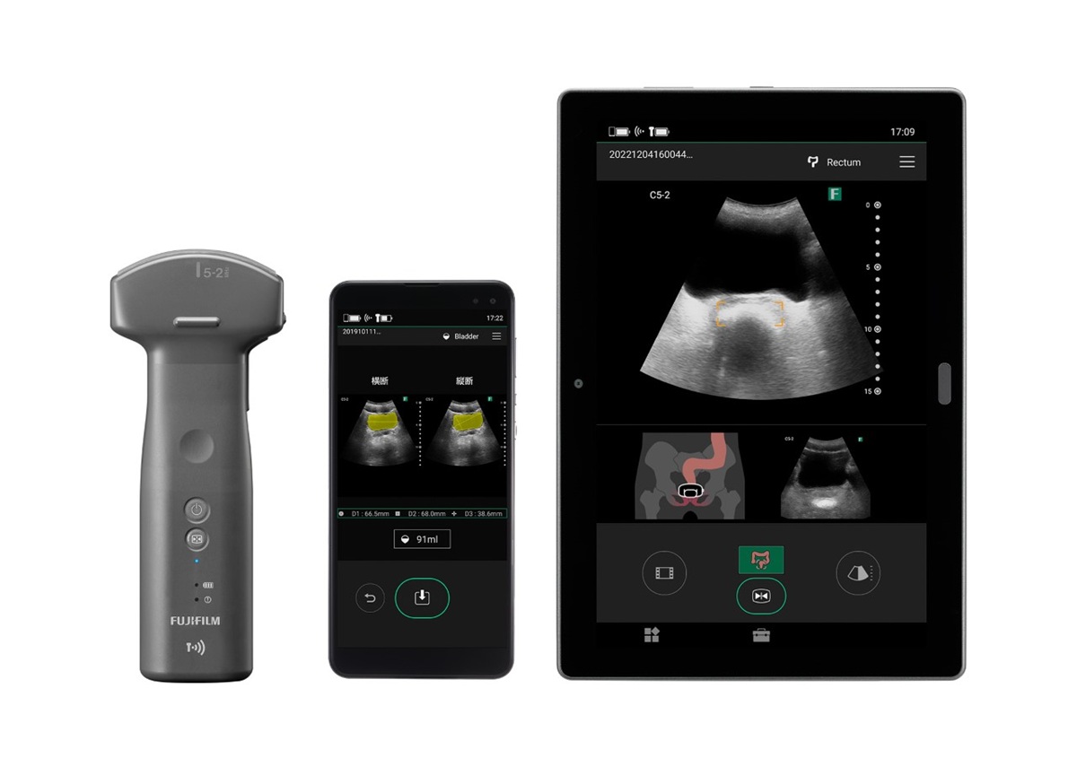 ポケットエコーが在宅医療を変える？排泄も嚥下も“見える化”、看護の現場に改革の画像1